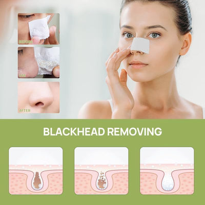 LANBENA Nose Pore Strips Cream